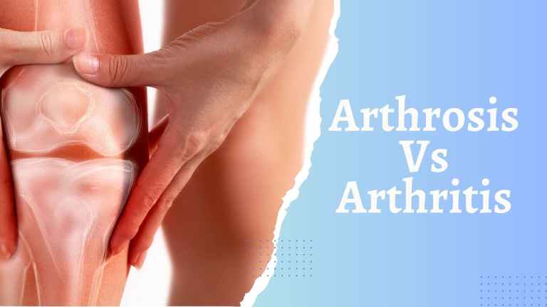 Arthrosis Vs Arthritis: Understanding The Differences And Similarities!
