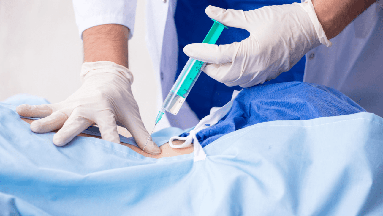 Benefits of getting an epidural injection