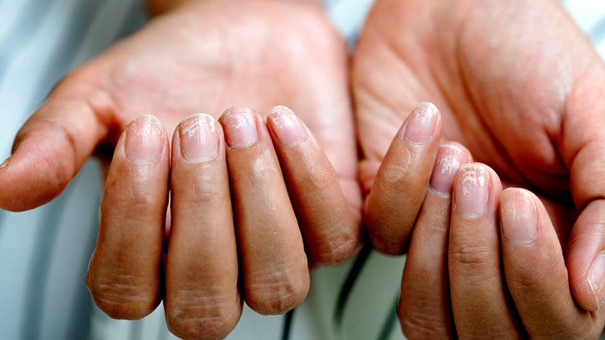 7 Possible Causes Of Fingernail Pain