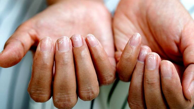 7 Possible Causes Of Fingernail Pain – A Quick Guide!