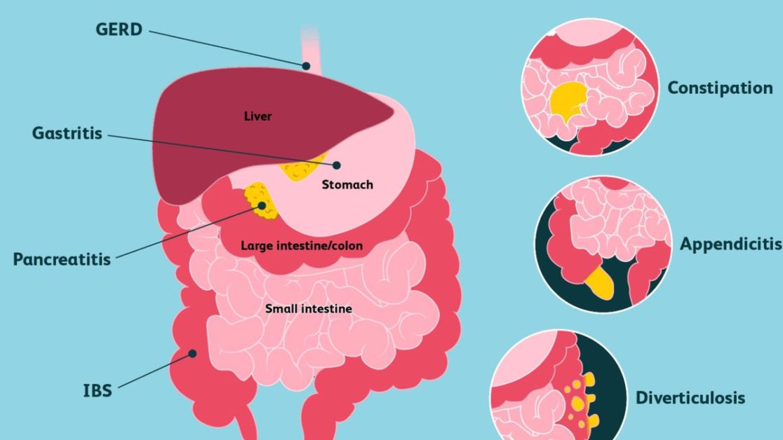 How To Relieve Stomach Pain 