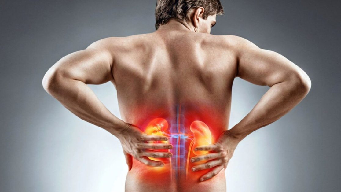 Kidney Pain