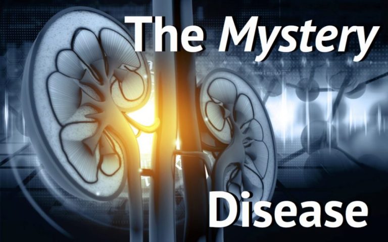 Is This My Illness? How to Diagnose Addison’s Disease