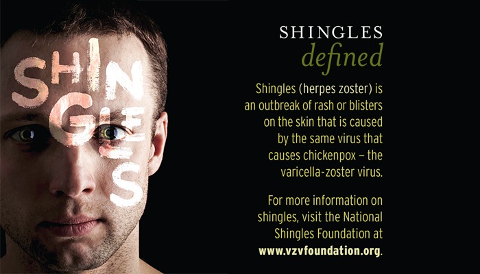 Shingles