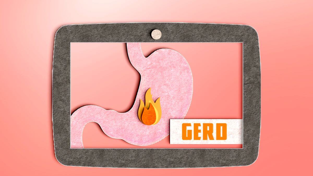 What causes GERD