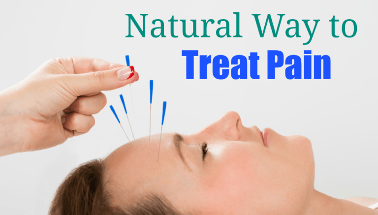 Revealing the Benefits of Acupuncture for Chronic Pain